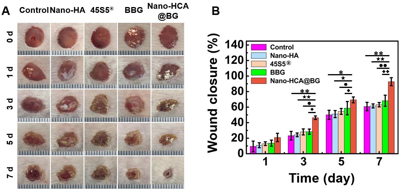 Nano-Scale Borate Bioactive Glass Reduces Biological Toxicity of Borate Bioglass.