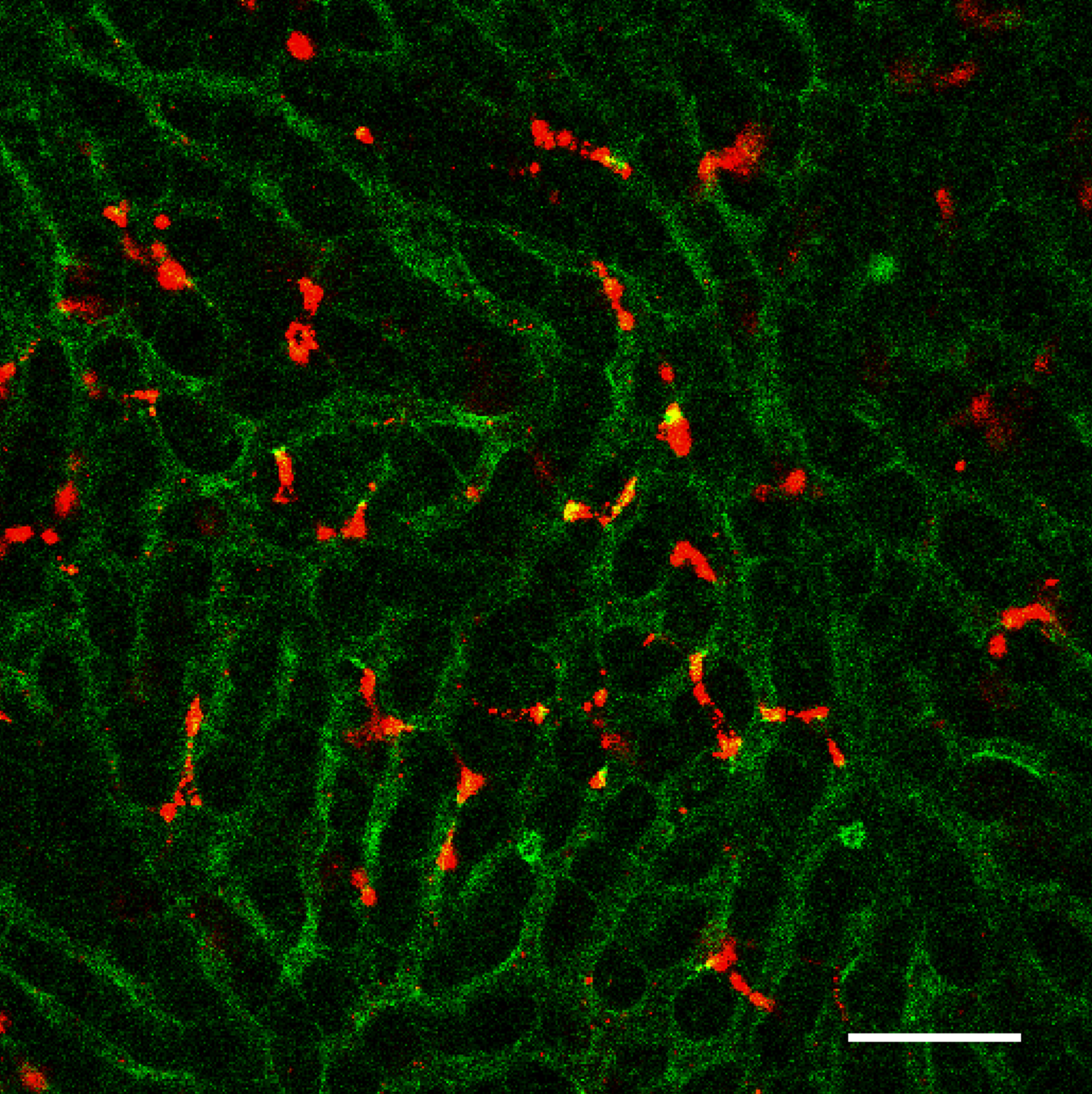 New Lipid Nanoparticles Could Help Overcome Resistance to Anti-Tumor Immunotherapy.