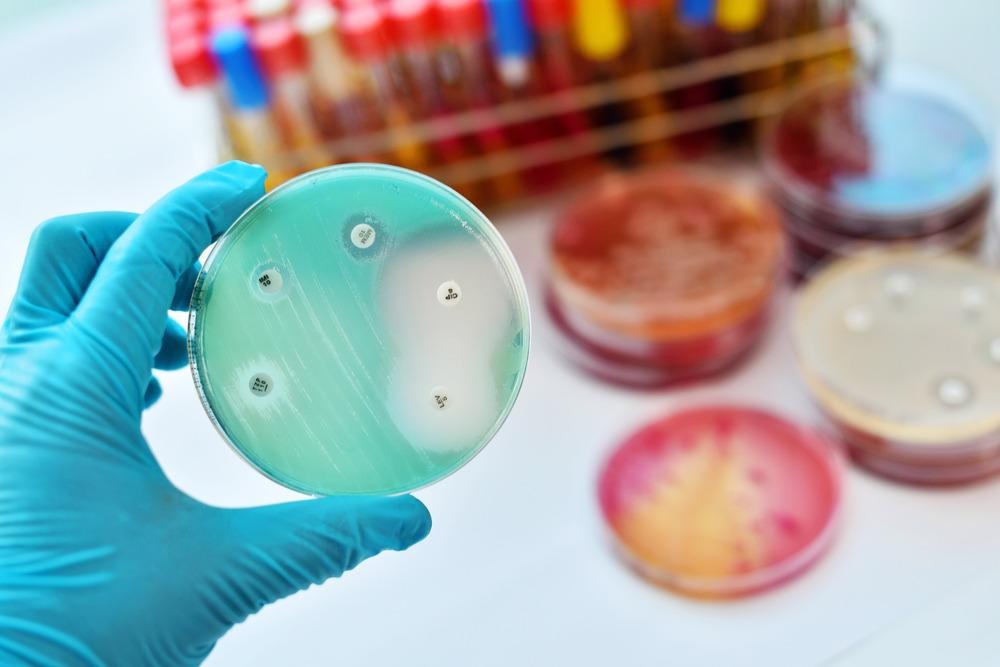antimicrobial, antibacterial, silver nanoparticles