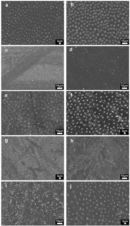 FESEM images of the dentin surfaces after EDTA-treatment and: (a) brushed with distilled water and (b) after-treated with citric acid; (c) brushed with toothpaste containing 1% of Zn-NPs and (d) after-treated with citric acid; (e) brushed with toothpaste containing 5% of Zn-NPs and (f) after-treated with citric acid; (g) brushed with toothpaste containing 10% of Zn-NPs, and (h) after-treated with citric acid; and (i) brushed with Sensodyne® toothpaste and (j) after-treated with citric acid. All images are taken at 2500× magnification.