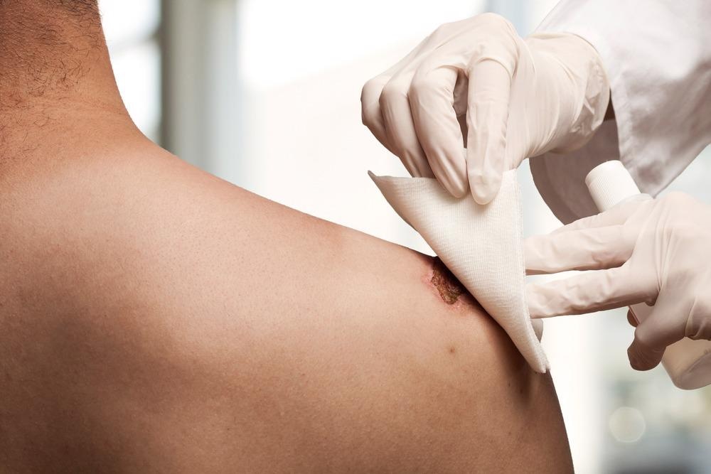 Wound healing, chronic wounds