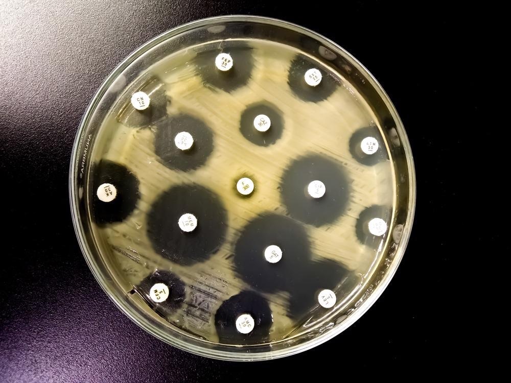 antibacterial, antimicrobial, graphene, zinc, nanoparticles