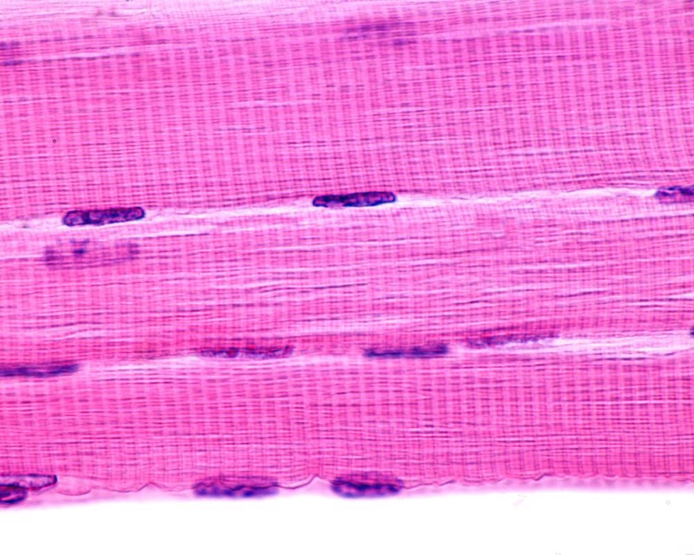 skeletal muscle