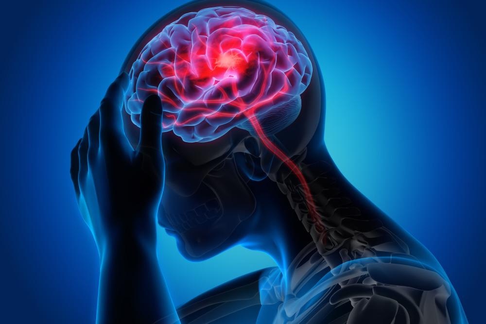 Nanomedicine Advances Brain Tumor Photodynamic Therapy