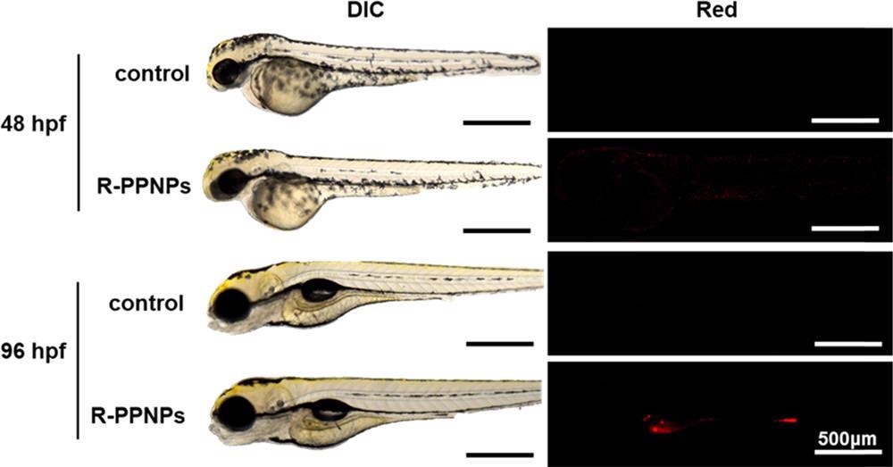 Optical and fluorescence images of zebrafish embryos with or without R-PPNP treatments at 24 and 72 hpf. These images were taken after 24 h exposure.