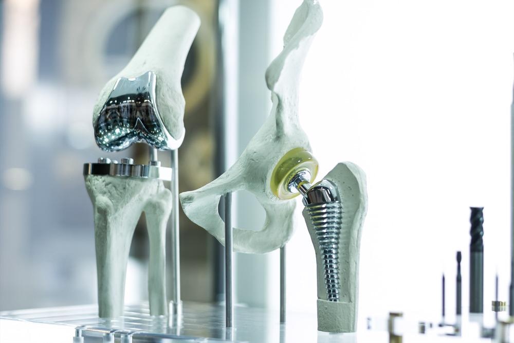 TiO2 Modification of Titanium Alloy Artificial Implants to Improve Performance