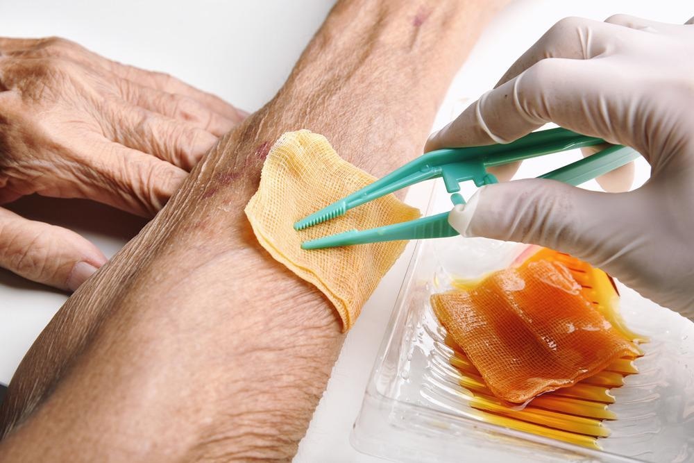 Self-Bonded Hydrogel Forms Basis of Flexible Wound Patch