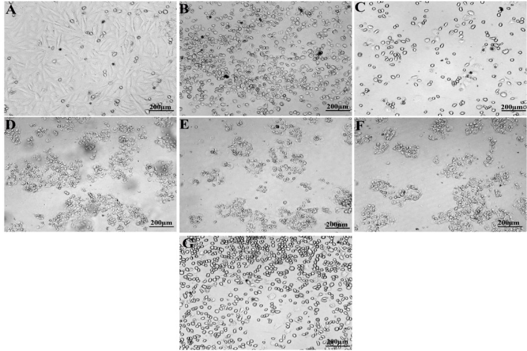 MTT assay of P-AgNPs from P. alba leaf extract against U118 MG cancer cell line. (A) Untreated cells, (B) Positive control, (C) 6.25 µg/mL, (D) 12.5 µg/mL, (E) 25 µg/mL, (F) 50 µg/mL, (G) 100 µg/mL.