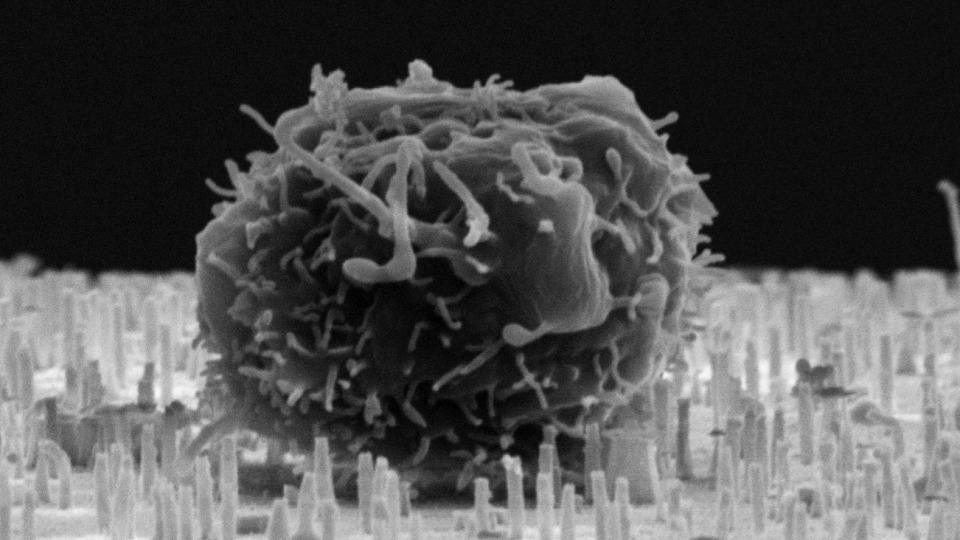 Novel Method to Multiply Blood Stem Cells Before a Stem Cell Transplant
