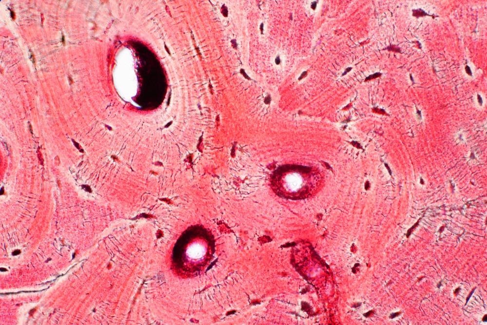New Combination Enhances Bone Tissue Engineering Biomaterial