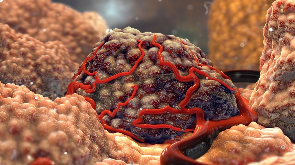 Combining Carbon Dots with Nanogels to Target Tumors