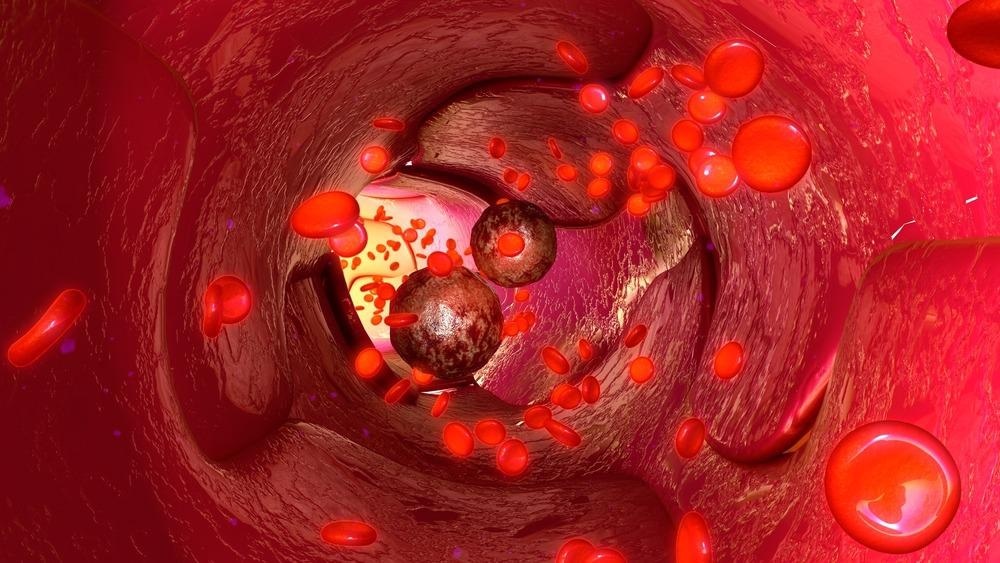 Keeping Track of Circulating Cancer Cells through Nanoparticle Chip