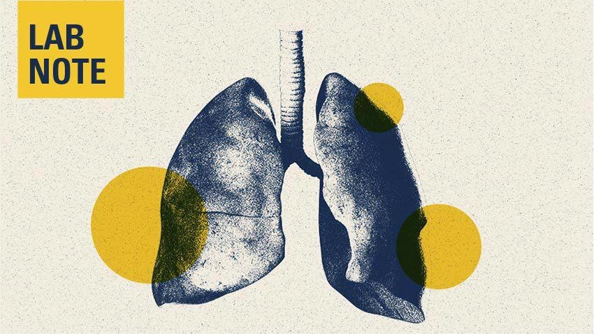 PLG Nanoparticles Inhibit Skin and Lung Fibrosis by Targeting MARCO+ Cells.
