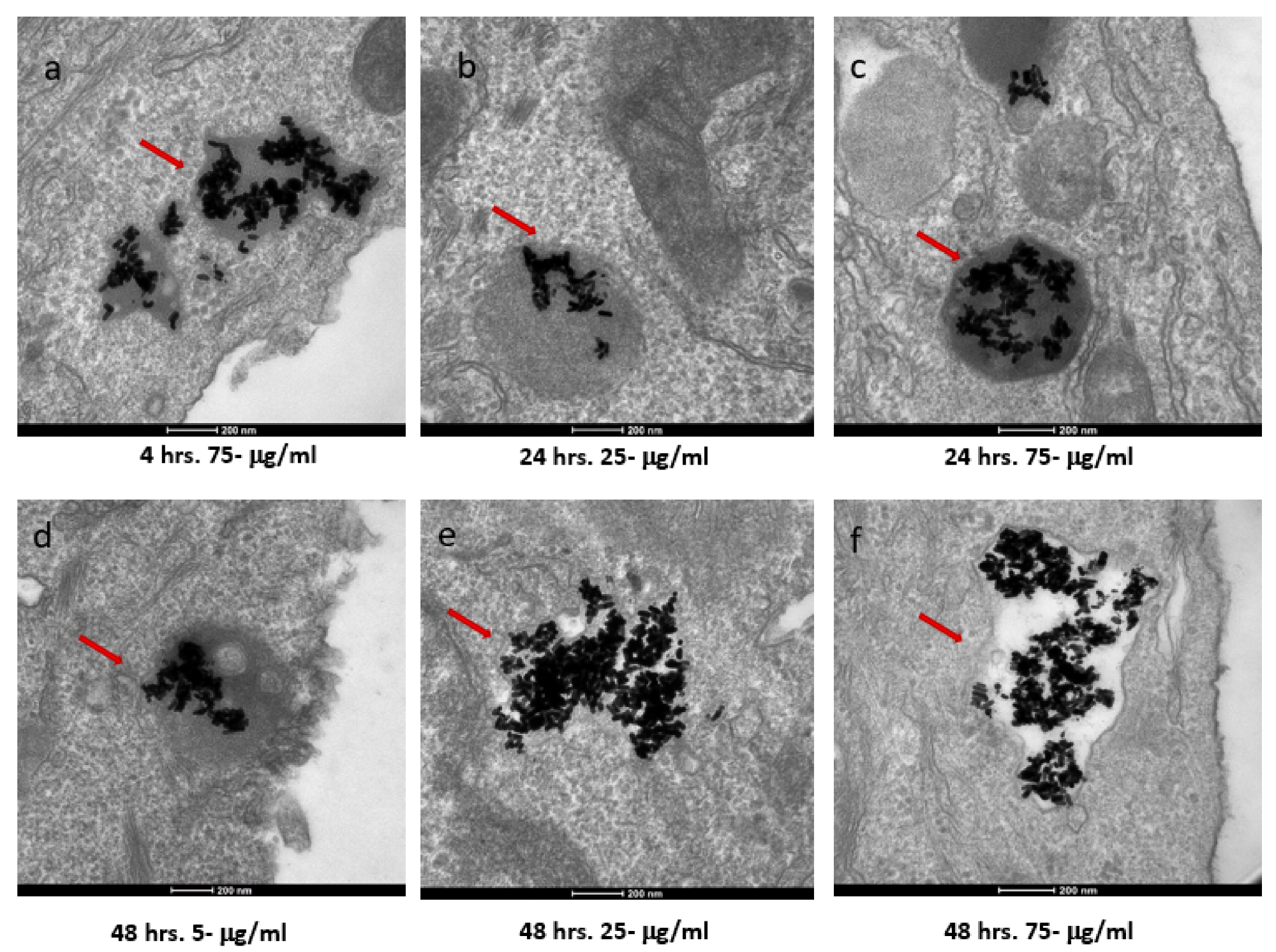 TEM images of AuNRs in SKBR-3 cells at different time points and concentrations. SKBR-3 cells were treated with 5, 25, and 75 µg/mL of AuNRs for 1, 4, 24, and 48 h. Internalization of nanorods was observed starting at 4 h incubation with 75 µg/mL (a). After 24 h of incubation, internalization was observed with the 25 µg/mL (b) and 75 µg/mL concentrations (c). For cells incubated for 48 h, we observed internalization with 5, 25, and 75 µg/mL concentrations (d, e, and f, respectively). Red arrows point to gold nanorods localized in SKBR-3 cells. Electron photomicrographs shown are representative of at least three independent experiments with similar conditions.