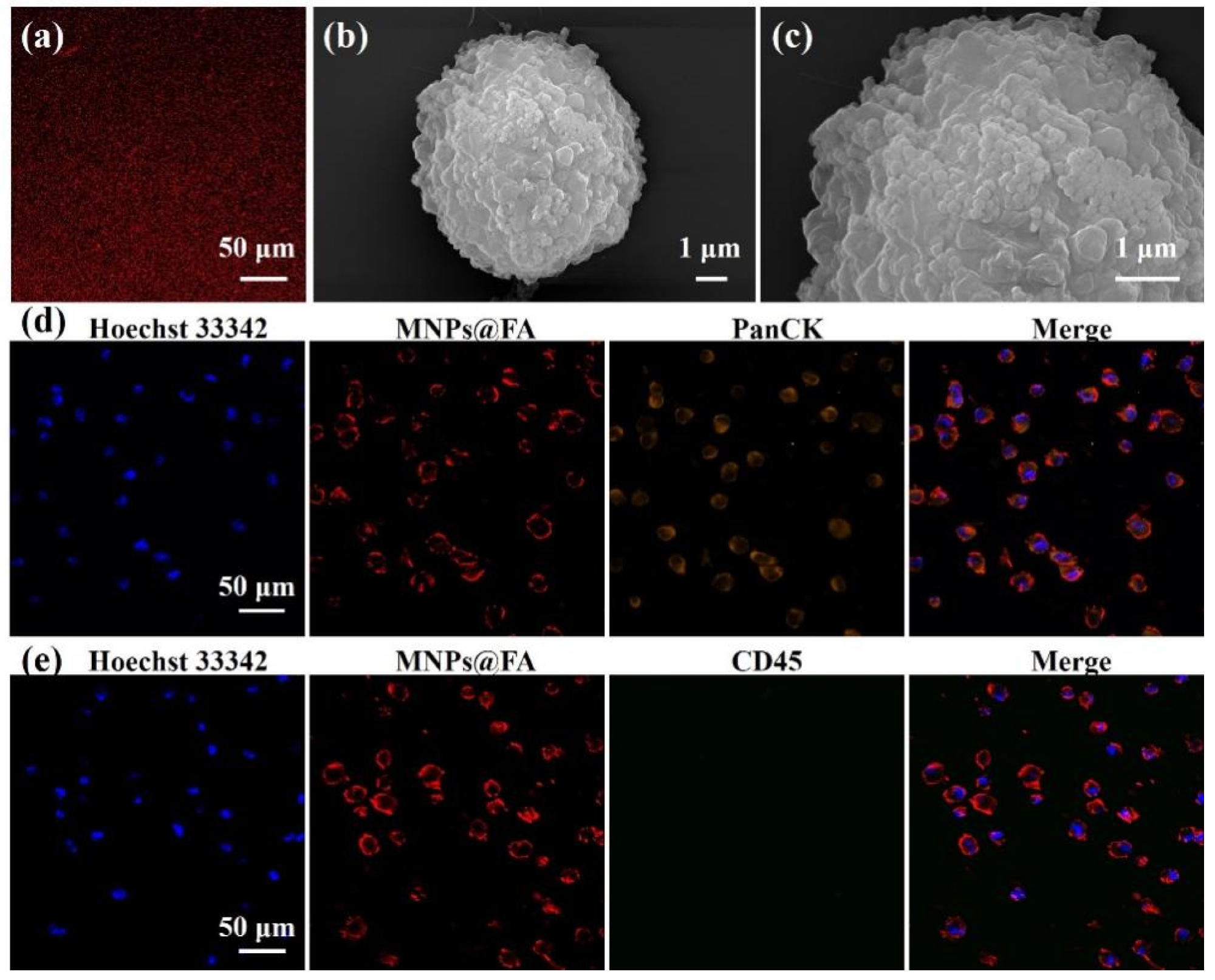 A fluorescent image of MNPs@FA showing a stable fluorescent signal. (b,c) SEM images of an SK-OV-3 cell captured by MNPs@FA with a sufficient number of nanoparticles on the cell surface. (d) Fluorescent images of SK-OV-3 cells captured by MNPs@FA (red) with immunostaining of anti-PanCK-555 (orange) and Hoechst 33,342 (blue). (e) Fluorescent images of SK-OV-3 cells captured by MNPs@FA (red) with immunostaining of anti-CD45-488 (green) and Hoechst 33,342 (blue).