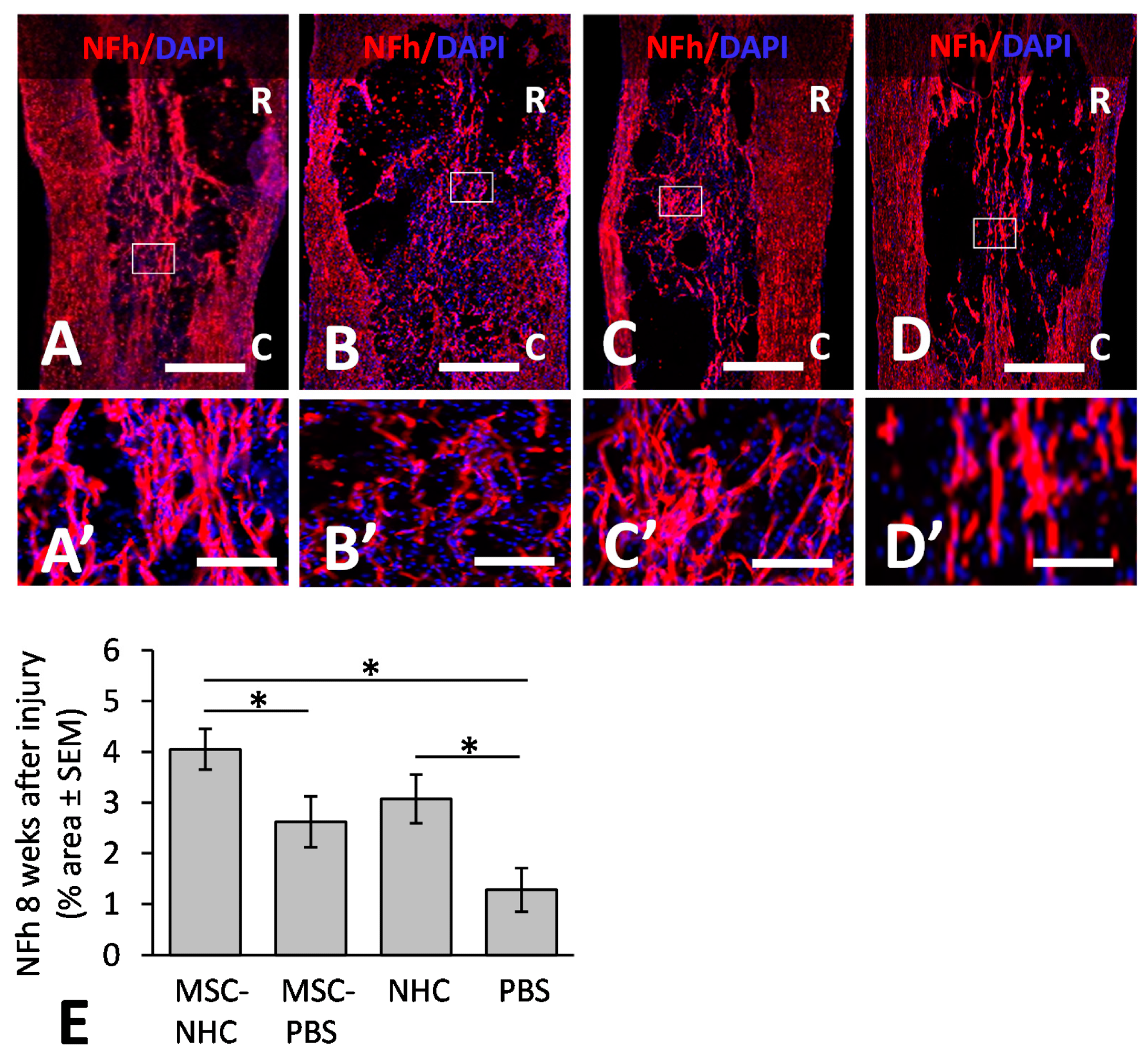 Axon presence in the injury site. Photomicrographs showing axons stained for NFh (red) in the injury site with MSC-NHC (A), MSC-PBS (B), NHC (C), or PBS (D) at 8 weeks after injury. Sections were counterstained with the nucleus marker, DAPI (blue). Images in panels (A’–D’) are enlargements of the outlined area in panels (A–D), respectively. The scale bar in (A–D ) is 450 µm. Scale bar in (A’,C’) is 125 µm, and 115 µm in (B’,D’). In (A–D), the rostral (R) and caudal (C) orientation of the horizontal sections are indicated. (E) Bar graph of the percentage area of injury site positive for NFh at 8 weeks after injury. There were significantly more NFh+ axons in the injury site with MSC-NHC compared with MSC-PBS and PBS only. Asterisks indicates p < 0.05. Bars in the graph represent SEM. Abbreviations: DAPI = 4
