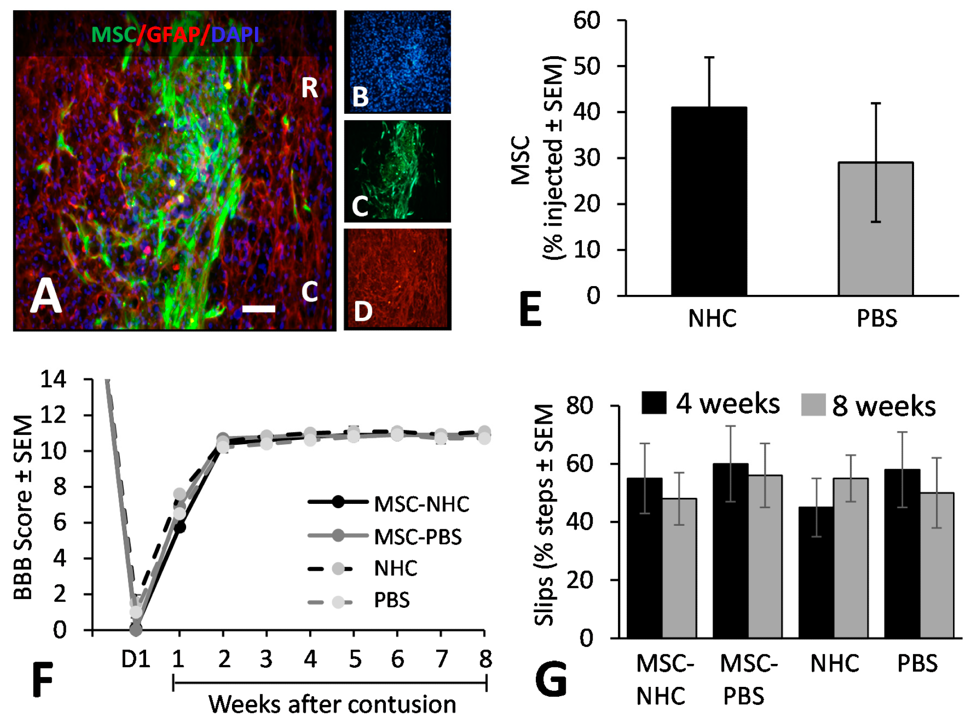 MSC transplant survival and hindlimb function. (A) Photomicrograph showing MSC (green), astrocytes (red, anti-GFAP), and cell nuclei (blue, DAPI) in the injury site with MSC-NHC at 1 week after injury. The scale bar in (A) is 180 µm. Scale bar in (B–D) is 550 µm. In (A), the rostral (R) and caudal (C) orientation of the horizontal section are indicated. (E) Bar graph showing the number of MSCs present in the injury site 1 week after injury. The difference in number between groups was not significant. (F) Line graph showing the BBB scores of the experimental groups on day 1 (d1) after injury and weekly thereafter. Differences between groups per time point were not statistically significant. In both graphs, the bars represent SEM. (G) Bar graph showing the total slips as a percentage of the total steps made by the rats to cross the horizontal ladder at 4 and 8 weeks after injury. Differences between groups per time point were not statistically significant. In all graphs, the bars represent SEM. Abbreviations: BBB = Basso, Beattie, Bresnahan; d = day; DAPI = 4