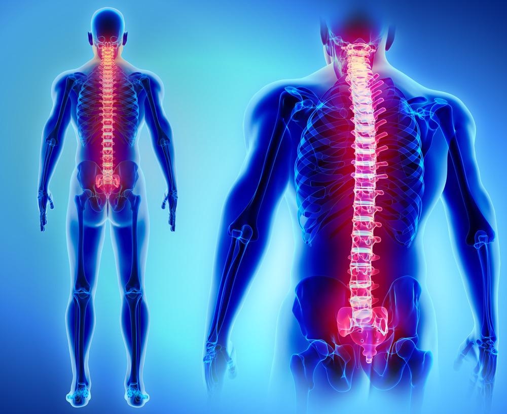 Nanofiber-Hydrogel Treatment for Spinal Cord Injury
