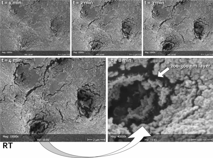 Representative micrographs of the same area (in this case belonging to RT), scanned at different times (1, 2, 3, 4, and 8 min) focusing the electron beam on the opening of tubules, thus heating the carbon-rich collagen structures underneath and disrupting the mineralized material obliterating the lumen. In this way, it was possible to measure the thickness of the deposited layer. The latter can be clearly seen as constituted by a homogeneous assembly of spherical nanoparticles. The absence of exposed HA prisms in this substratum did not allow for epitaxial growth; therefore, no HA nanocrystals could be identified independently from the tested formulations. Considering the treatment time that was allowed in this study (one week), it can be speculated that the tested formulations might need to incorporate a scaffold in order to be able to grow organized structures on the dentinal substrate.