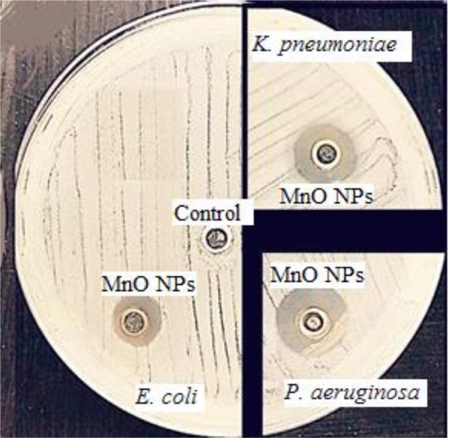Scanned of antimicrobial activity of MnO NPs against E. coli, K. pneumoniae, and P. aeruginosa.