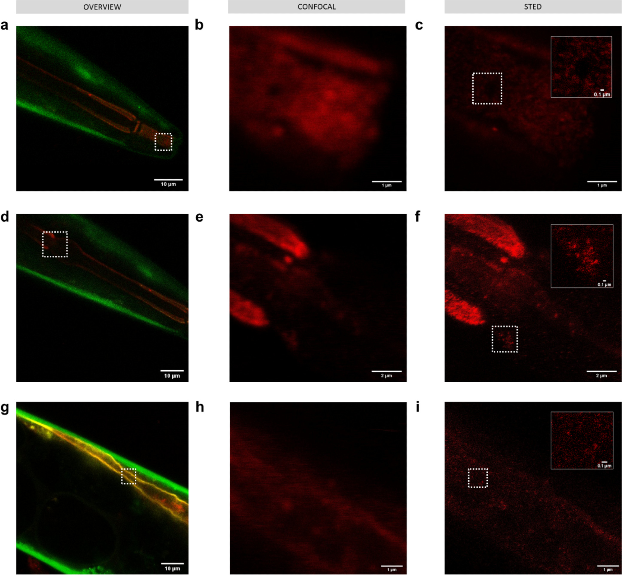 Imaging 50 nm polystyrene nanoplastics passively labeled with Atto 647N (red) in C. elegans KWN117 adult expressing GFP (green) in the body wall and mCherry (yellow) in the apical intestinal membrane. Confocal overview and high resolution of confocal and STED images of the scanned area indicated by white boxes for parts of the digestive track in the mouth (a–c), pharynx (d–f), and intestine (g–i). Insets in STED images correspond to the areas indicated by white boxes.