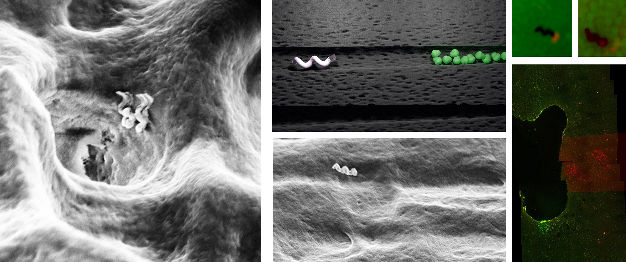Nanobots That Can Assist In Accurate Root Canal Treatments