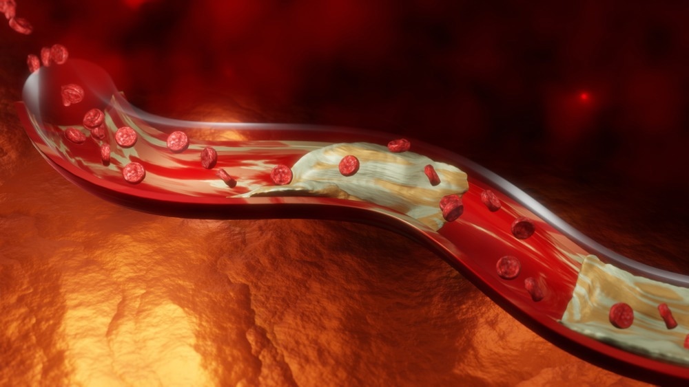 Nanotubes Aid Non-Enzymatic Sensing of Cholesterol