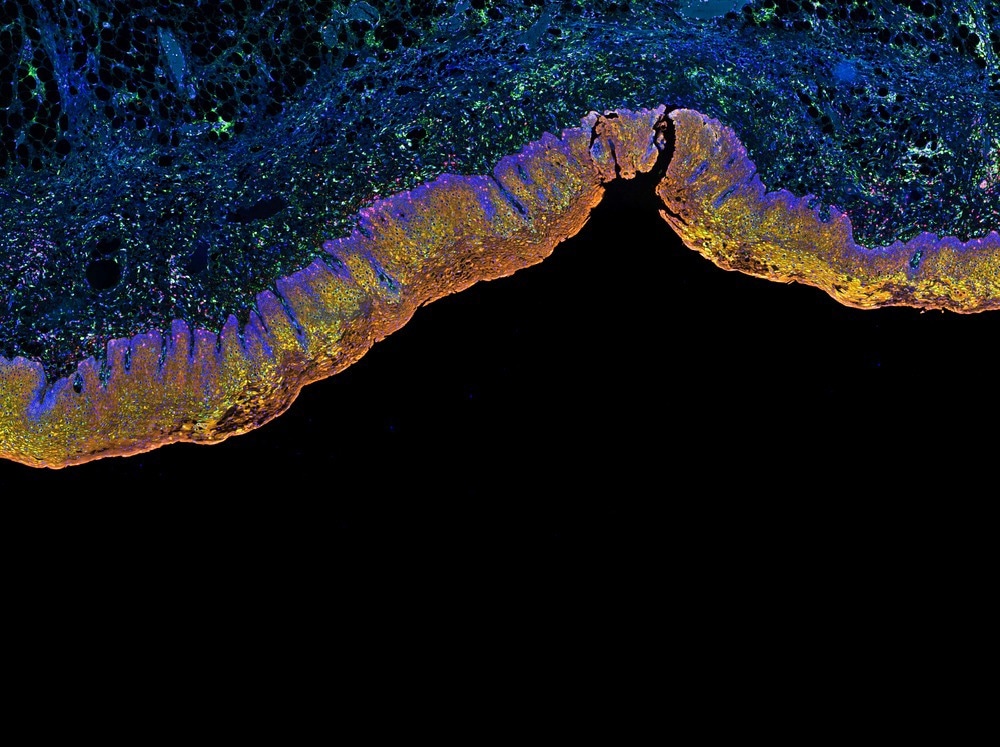 Gold Nanoshells Enhance LDI-MS Tissue Imaging