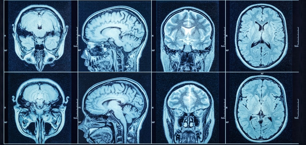 Green Nanoparticles Synthesized for CT Imaging Applications