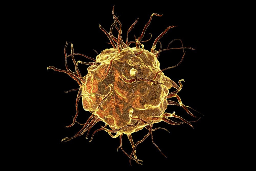 Macrophages Polarized to Kill Cancer Cells with Nanotechnology
