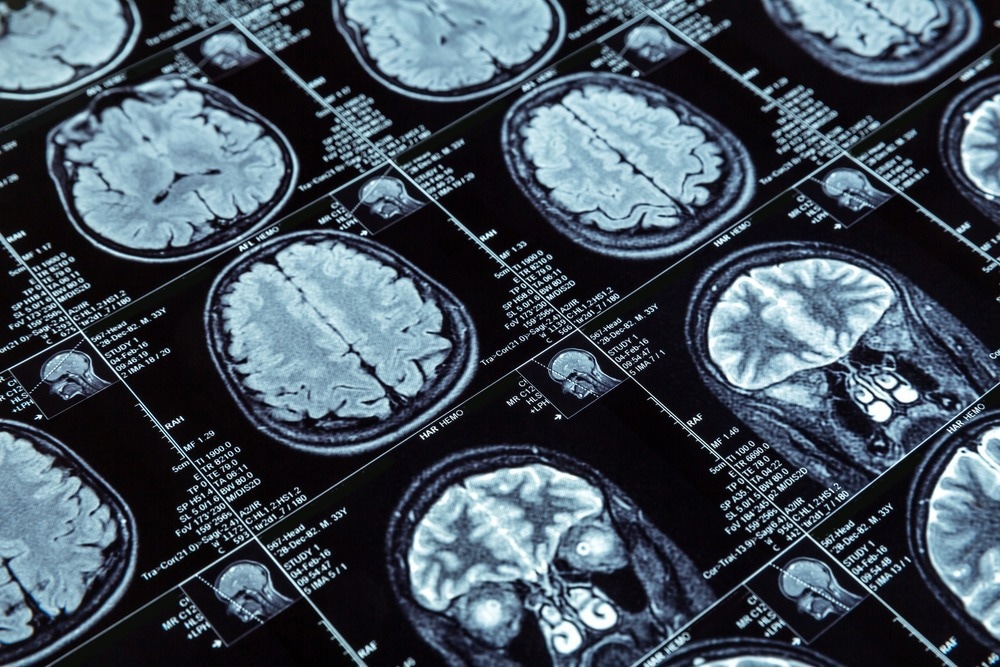 SESORS Comes One Step Closer to Clinical Use