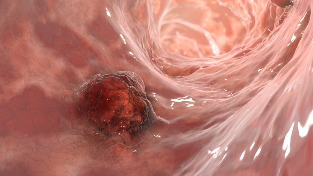 Semiconducting Polymer Nanoparticles to Target Deep-Tissue Tumors