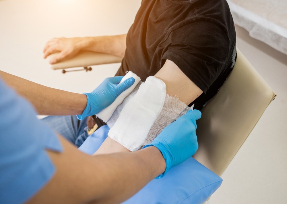 Nanofibrous Dressing Could Help Accelerate Severe Burn Healing