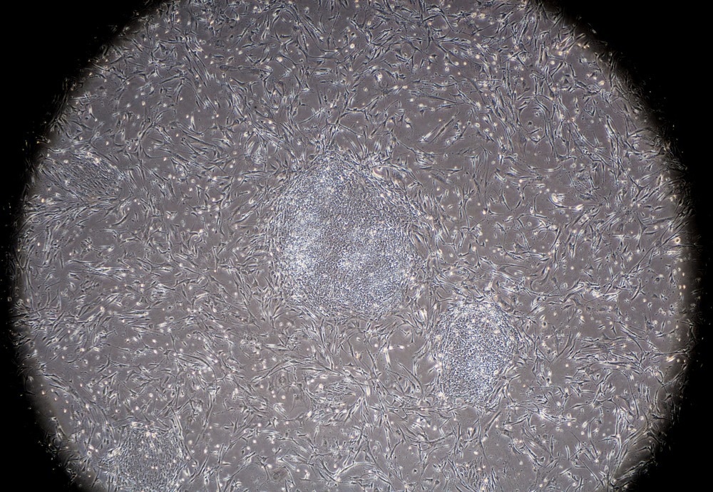 iPSCs-Derived Neurons Successfully Grown on Nanowire Arrays