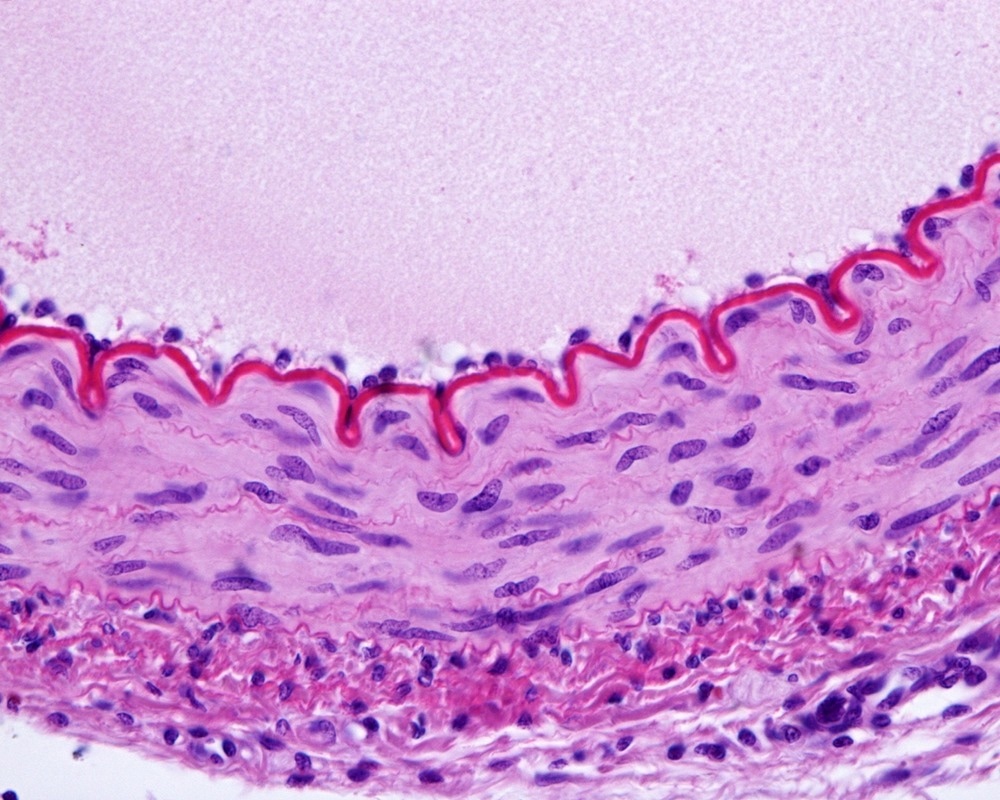 Certain Nanoplastics Can Cause Holes Between Endothelial Cells