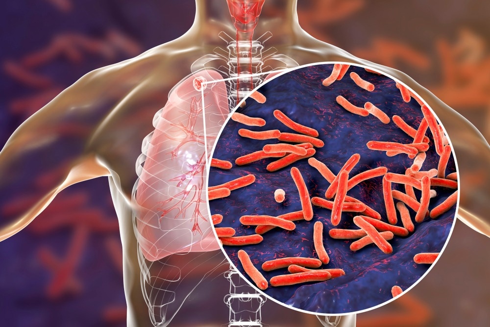 Seaweed Suggested As Source of Anti-Tuberculosis Nanoparticles