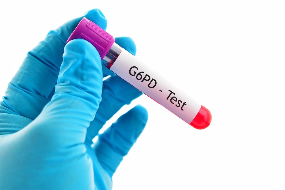 Ratiometric Fluorescence Approach to Detecting G6PD