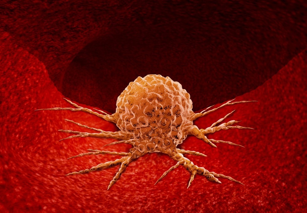 Raspberry-Like Nanoadjuvants Help Target Deep Tissue Tumors