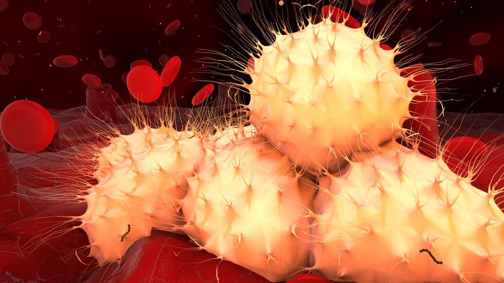 Graphdiyne Oxide Effective Against AML Caused by DNMT3A Mutation