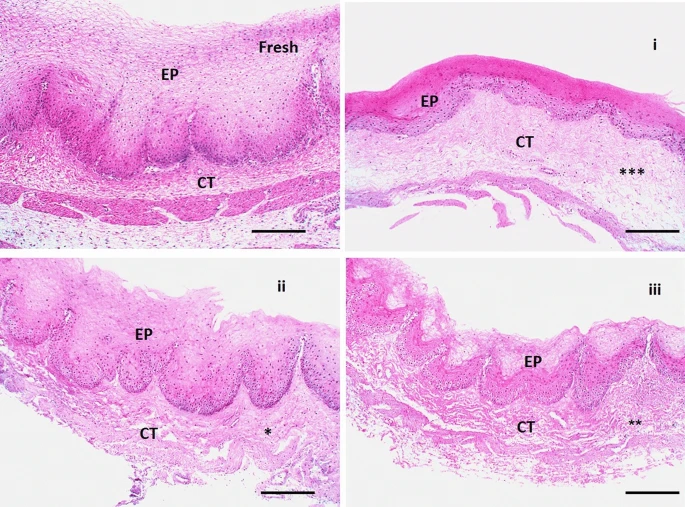 Histopathological pictures of chicken cysts mucosa utilized in ex vivo permeation for a fresh sample as control mucosa, (i) mucosa exposure to VEN solution, (ii) mucosa exposure to plain NFs, and (iii) mucosa exposure to medicated NFs (F3) using H&E stain X:100 bar 100. (*??<?0.05, ** ??<?0.01, ***??<?0.001 vs corresponding value of fresh group).