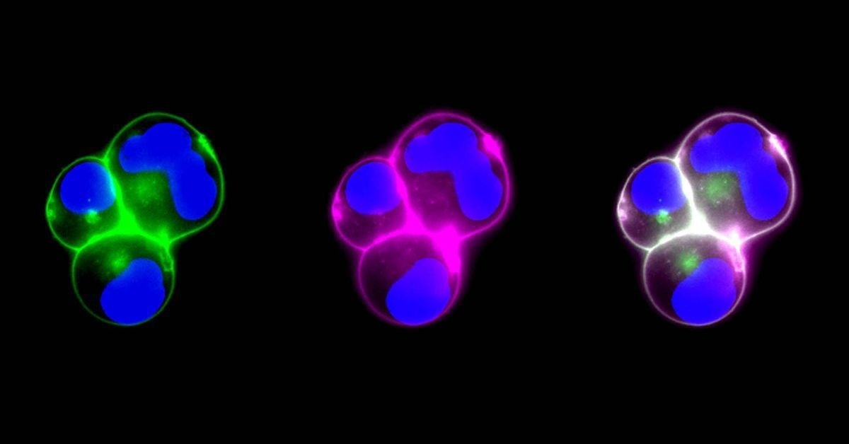 Improved Function of Cell Membrane-Coated Nanoparticles Through Genetic Engineering