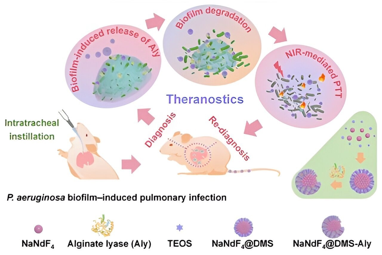 Schematic representation of noninvasive theranostic Aly-NaNdF4 nanohybrids against P. aeruginosa biofilm induced pulmonary infection.