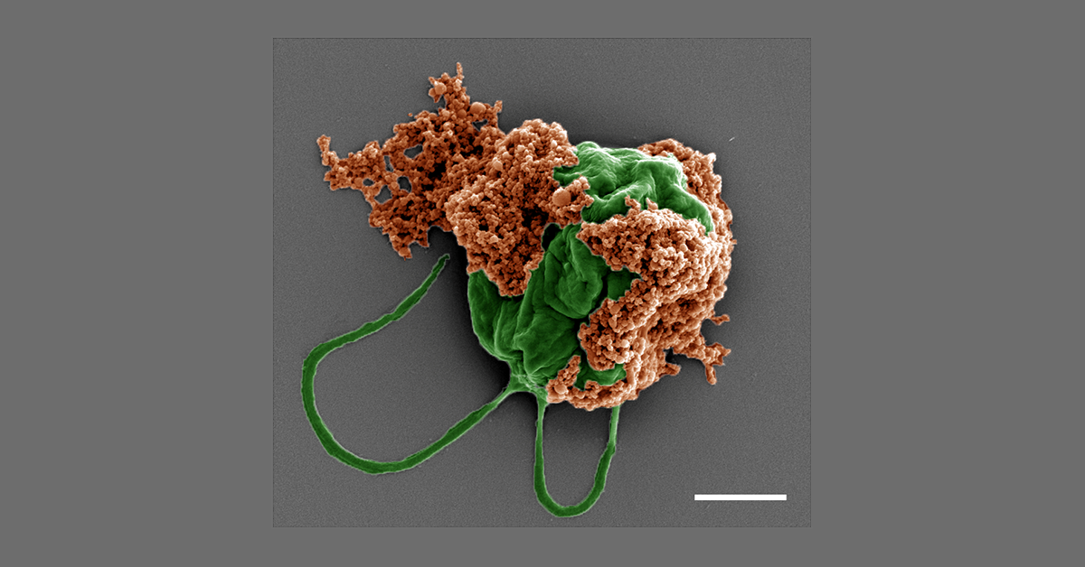Colored SEM image of a microrobot made of an algae cell (green) covered with drug-filled nanoparticles (orange) coated with red blood cell membranes.