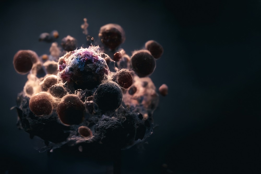 Chitosan Nanoparticles for Curcumin Delivery in Breast Cancer Treatment