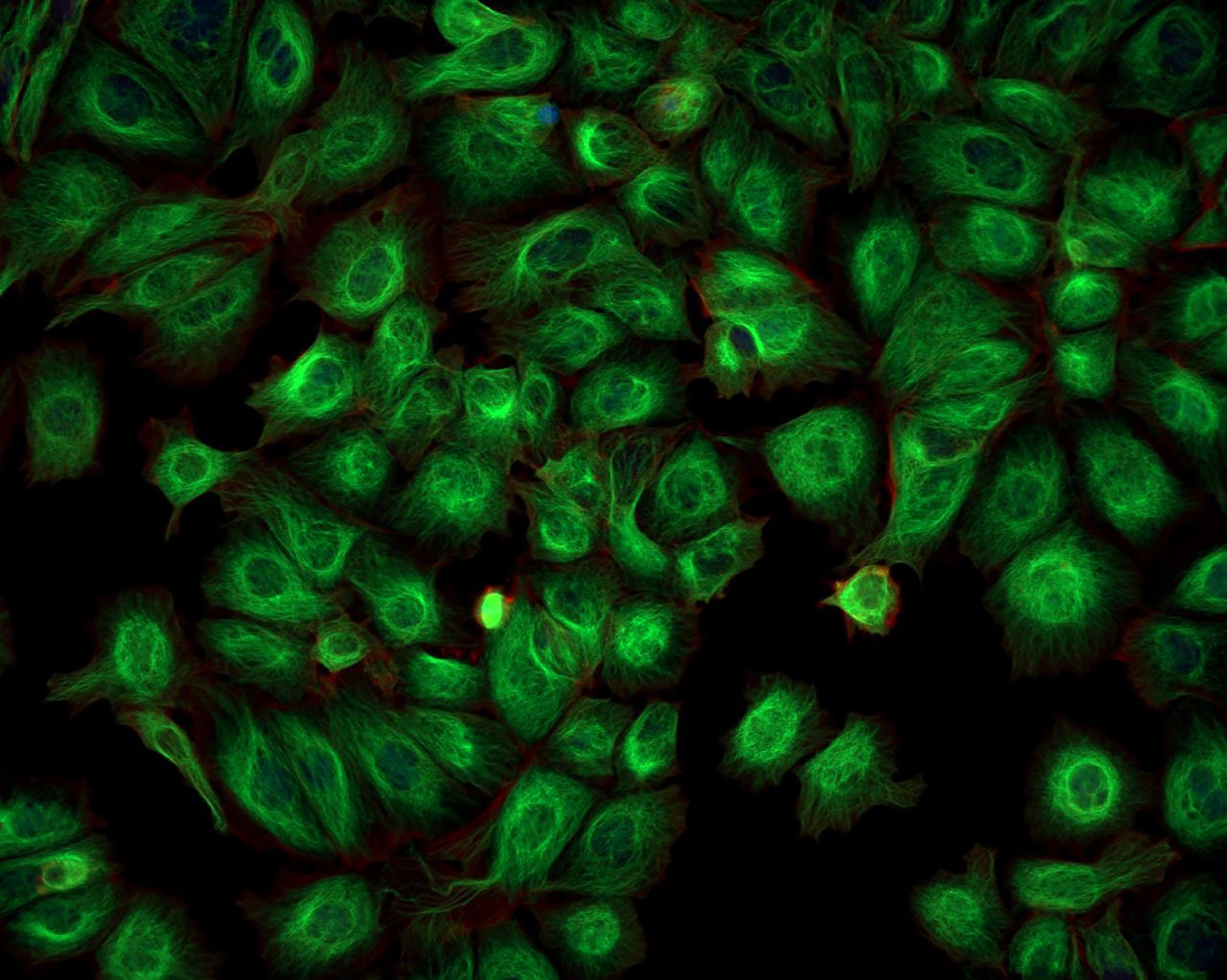 Destabilized Near-Infrared Nanobodies for Enhanced GFP Imaging