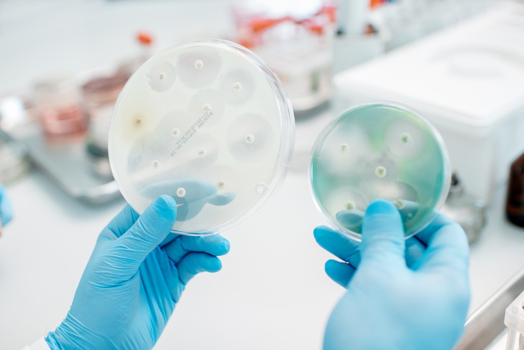 Light-Activated Azo-Fluorescent Switch for Enhanced Antifungal Therapy