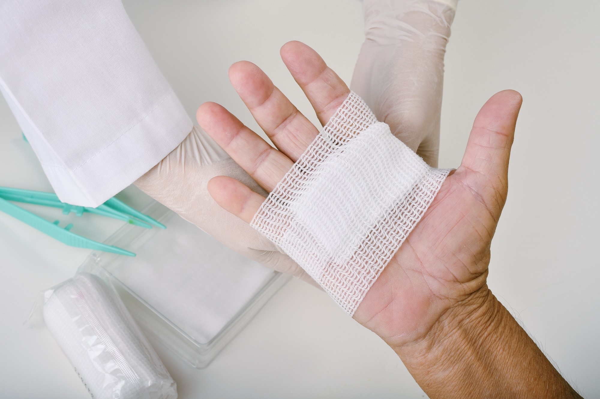 Chitosan-Silver Nanocrystal-Graphene Oxide Electrospun Fibers for Advanced Wound Dressings