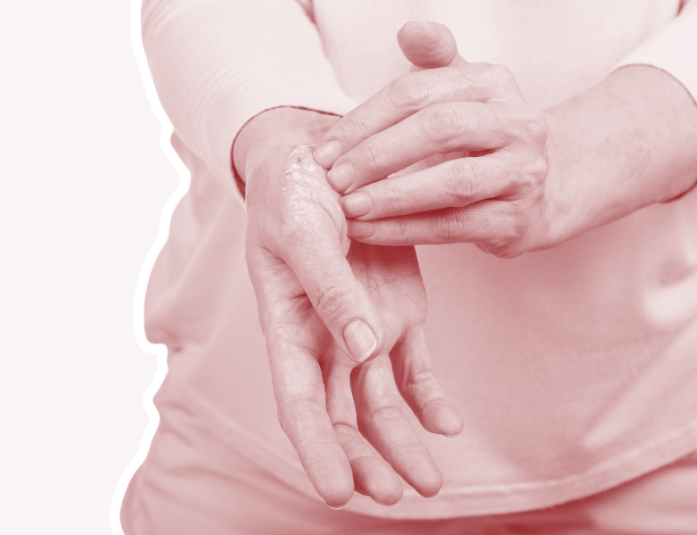 Novel Patch for the Treatment of Psoriasis and Other Inflammatory Skin Conditions
