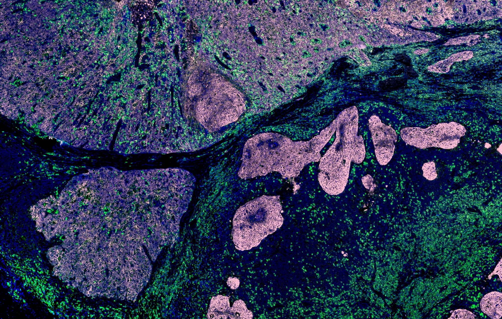 Microscopic view of cellular structures with green and purple highlights, representing senescent cell analysis.