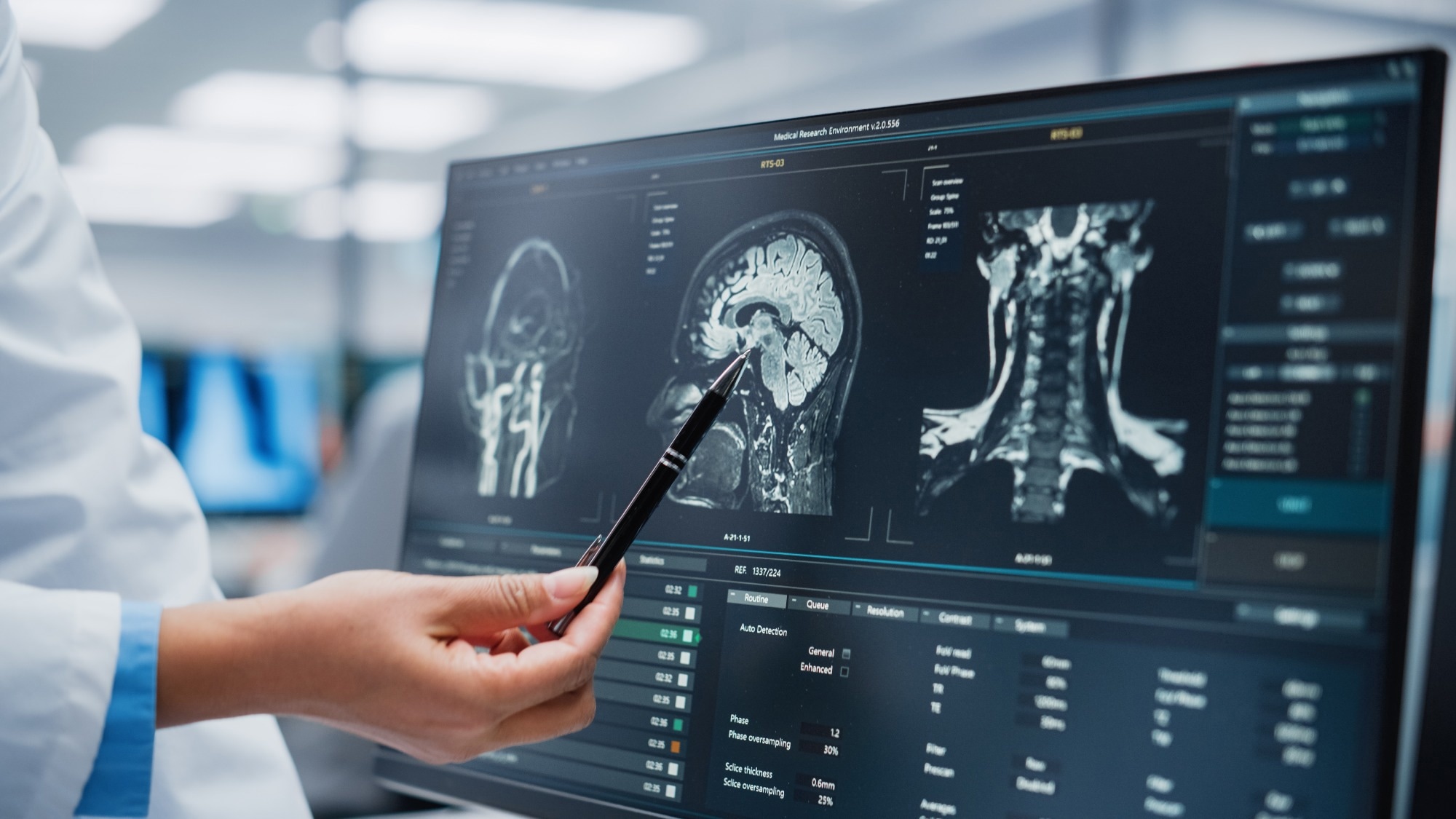 A medical professional in a lab coat is pointing to a detailed MRI scan of a brain and neck on a computer screen, analyzing the images with a pen. The screen displays various imaging results and settings.